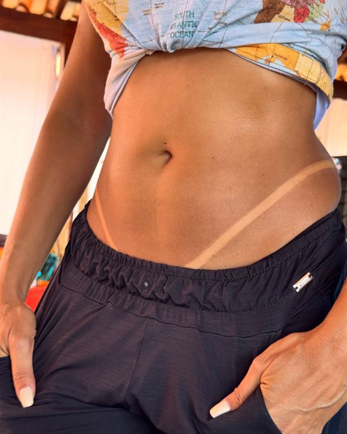 Barriga bronzeada de uma cliente de calça escura e blusa amarrada, com as linhas claras da marquinha no quadril.