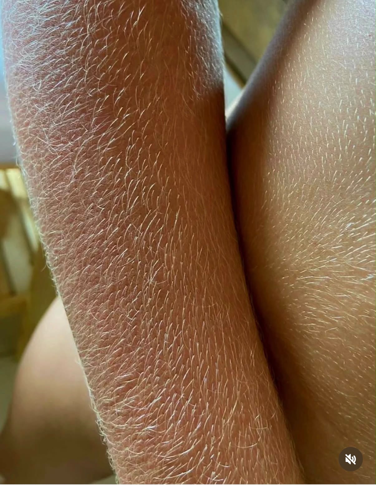 Pelos do corpo dourados e quase invisíveis após o banho de lua.
